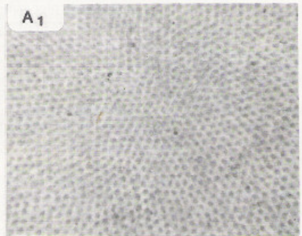 cones in the fovea have a dense regular packing