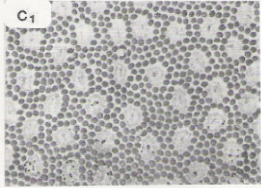 spacing of cones in the periphery is less dense and less regular